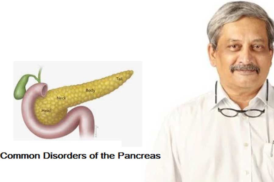 Health Disease Common Disorders of the Pancreas by Dr Rajeev Jayadevan