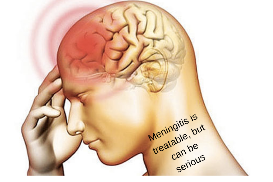 Meningitis Causes Symptoms Treatment