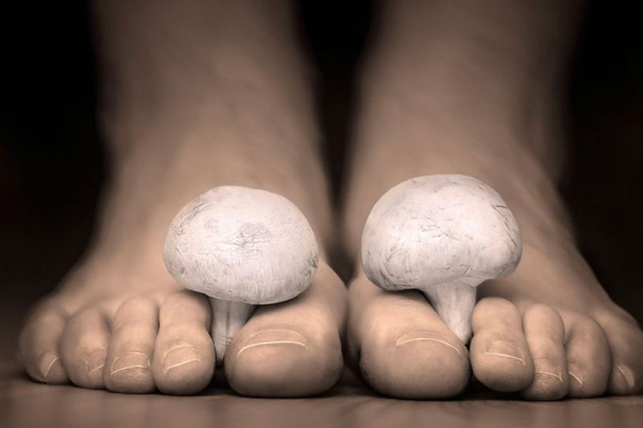 Athletes Foot Treatment Causes and Symptoms